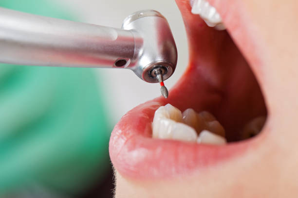 Best Urgent Tooth Repair  in White Island Shores, MA